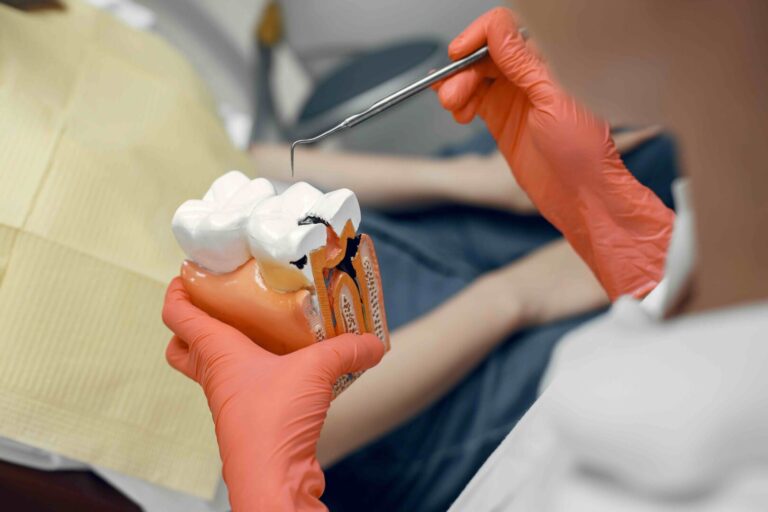 Carie e mal di denti