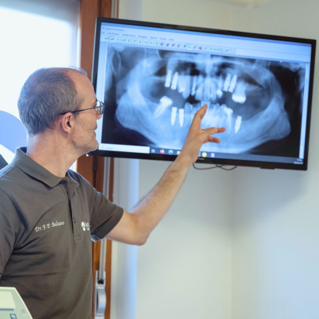 Implantologia 15 impianto dentale a San Mauro Torinese
