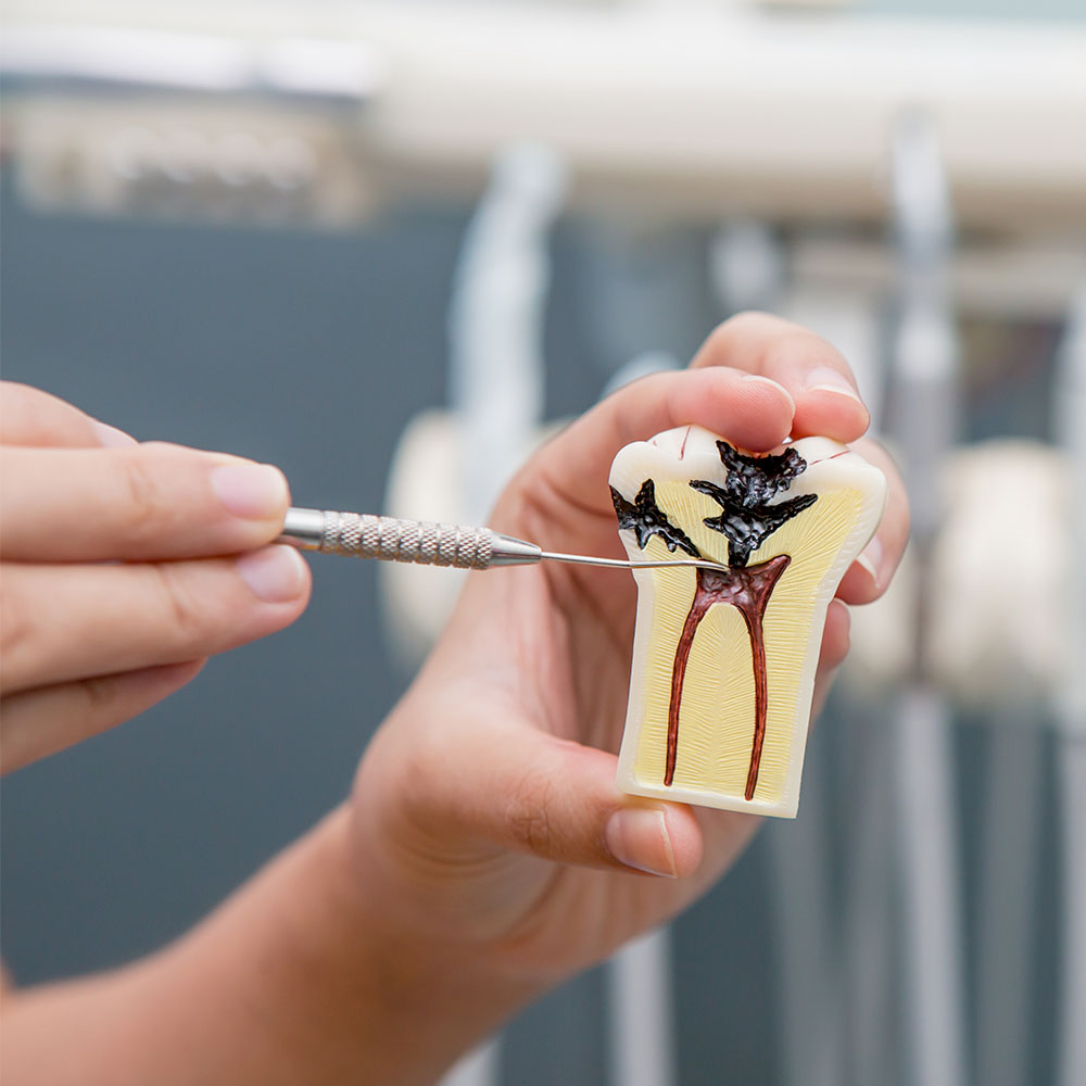 Endodonzia