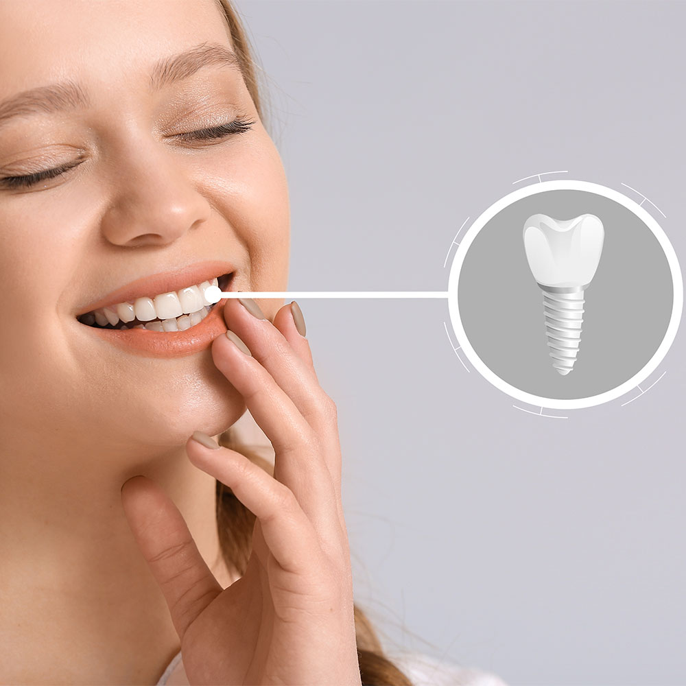 Endodonzia