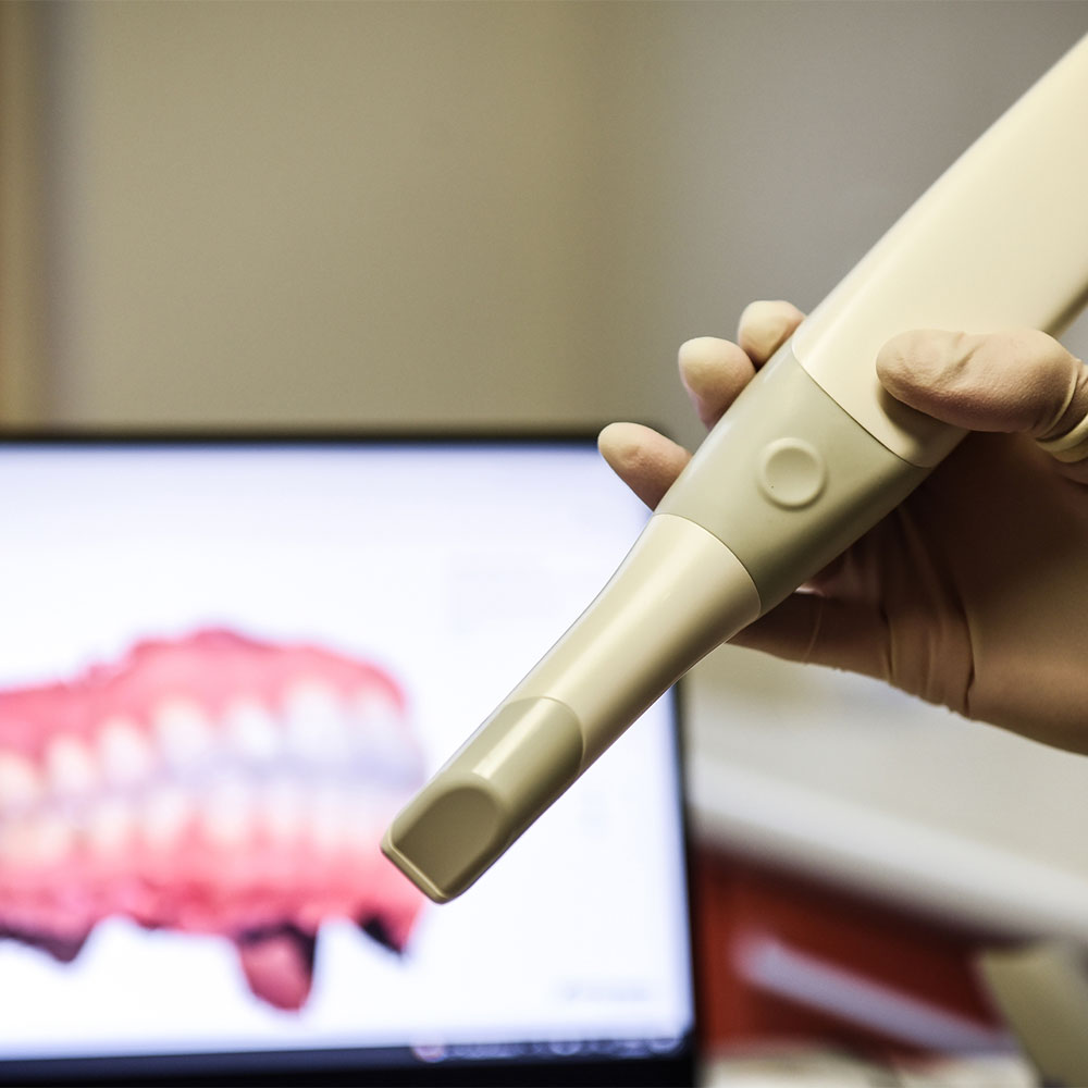 Tecnologia scanner orale 3D